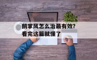鹅掌风怎么治最有效？看完这篇就懂了