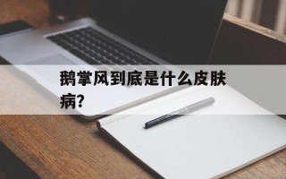 鹅掌风到底是什么皮肤病？
