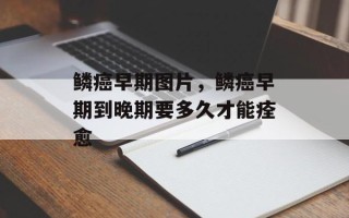 鳞癌早期图片，鳞癌早期到晚期要多久才能痊愈