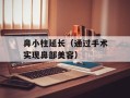 鼻小柱延长（通过手术实现鼻部美容）