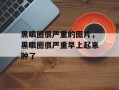 黑眼圈很严重的图片，黑眼圈很严重早上起来肿了